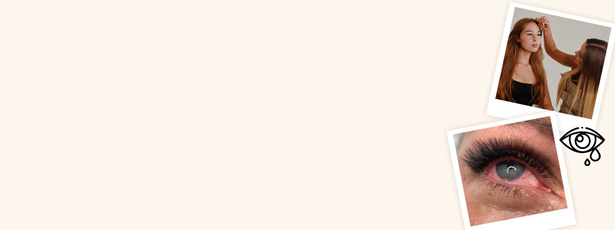 Allergic Reactions to Lash Extensions | London Lash USA